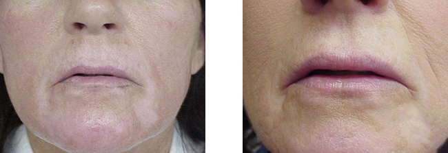 corrections in permanent makeup