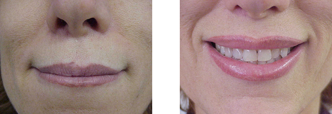 corrections in permanent makeup