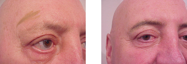 male brow and lash encahncements with permanent makeup
